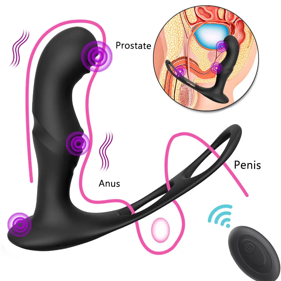 Extase Prostático: Massageador Anal Masculino com Controle Remoto e 10 Velocidades